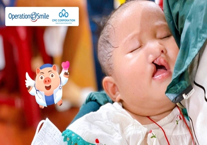 Cùng Tập đoàn CMC biến ước mơ về nụ cười lành lặn của 28 em bé hở môi, hàm ếch thành sự thật